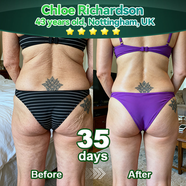 MHRA | Official UK 🇬🇧 Store |🏥𝘋𝘌𝘌𝘝𝘖𝘖® 𝑆𝑡𝑒𝑚 𝐶𝑒𝑙𝑙 & 𝐶𝑜𝑙𝑙𝑎𝑔𝑒𝑛 𝑃𝑒𝑝𝑡𝑖𝑑𝑒 𝑂𝑟𝑎𝑙 𝐷𝑟𝑜𝑝𝑠 (Lift & Firm Sagging Skin & Reduce Wrinkle Formation)✨