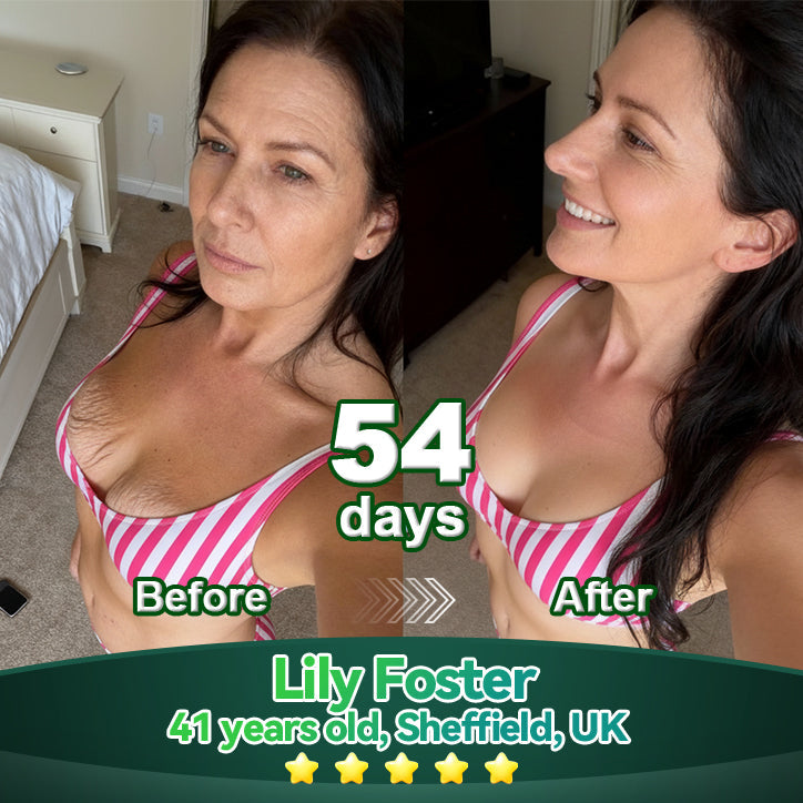 MHRA | Official UK 🇬🇧 Store |🏥𝘋𝘌𝘌𝘝𝘖𝘖® 𝑆𝑡𝑒𝑚 𝐶𝑒𝑙𝑙 & 𝐶𝑜𝑙𝑙𝑎𝑔𝑒𝑛 𝑃𝑒𝑝𝑡𝑖𝑑𝑒 𝑂𝑟𝑎𝑙 𝐷𝑟𝑜𝑝𝑠 (Lift & Firm Sagging Skin & Reduce Wrinkle Formation)✨